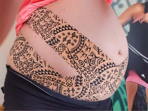 Taping dynamiczny w uroginekologii